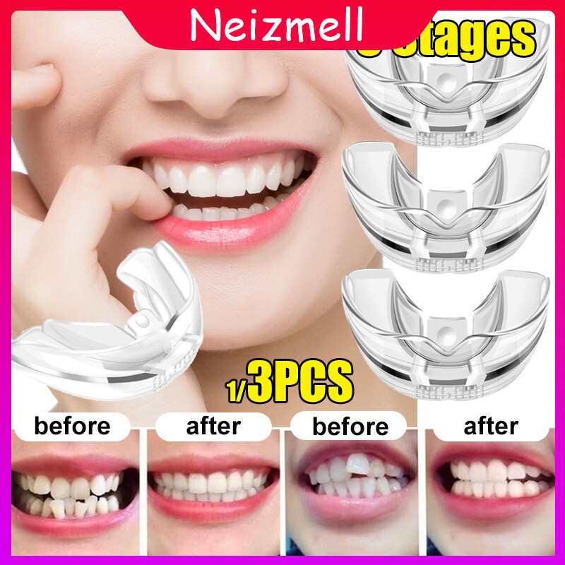 Neizmell 1 Set Phase 1-3 4D Invisible Teeth Orthodontic Aligner Straightener Appliance Alignment Transparent Braces Tooth Guard Anti-wear Teeth Free Portable Box